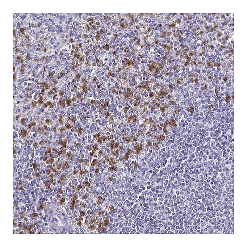 Atlas Antibodies Anti-TLR4 Antibody