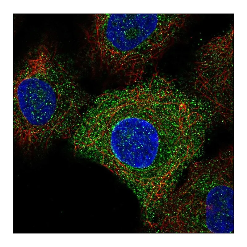 Atlas Antibodies Anti-TLR6 Antibody