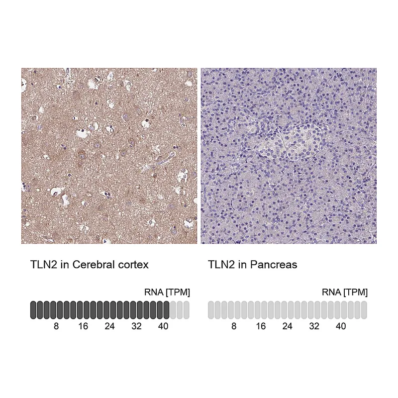Atlas Antibodies Anti-TLN2 Antibody
