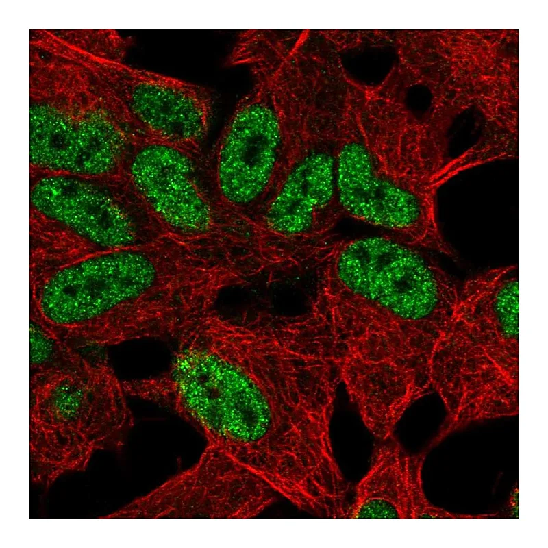 Atlas Antibodies Anti-TLX2 Antibody