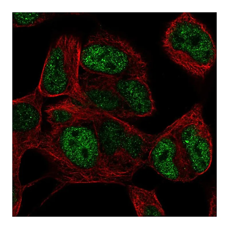 Atlas Antibodies Anti-TLX3 Antibody