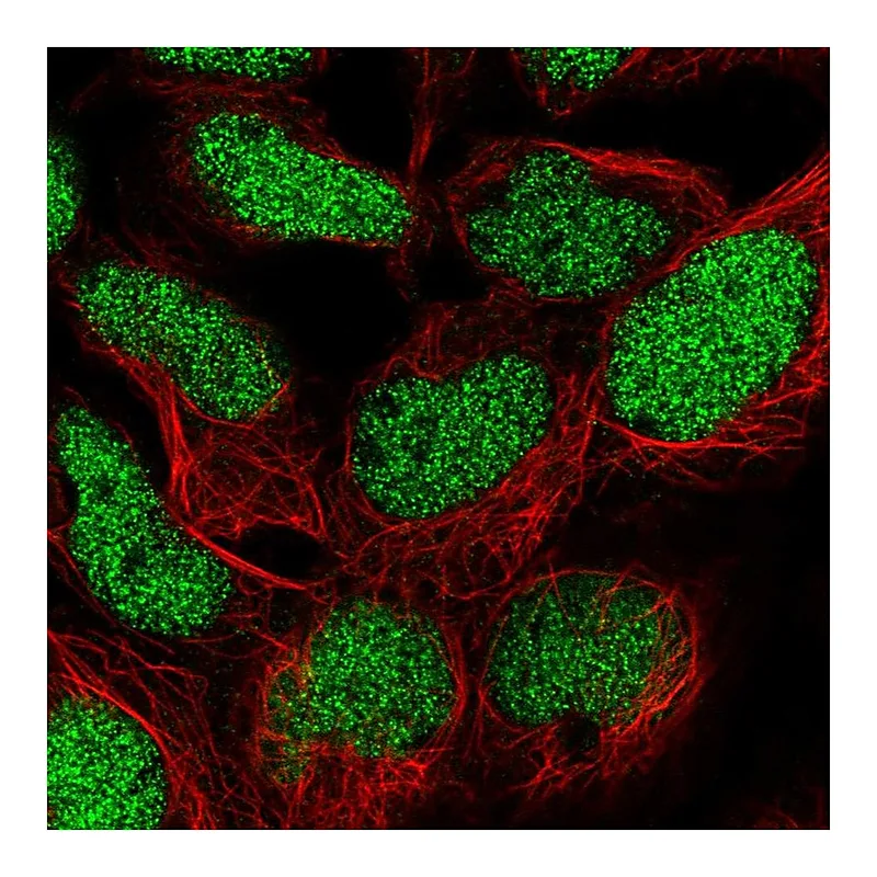 Atlas Antibodies Anti-TM2D1 Antibody