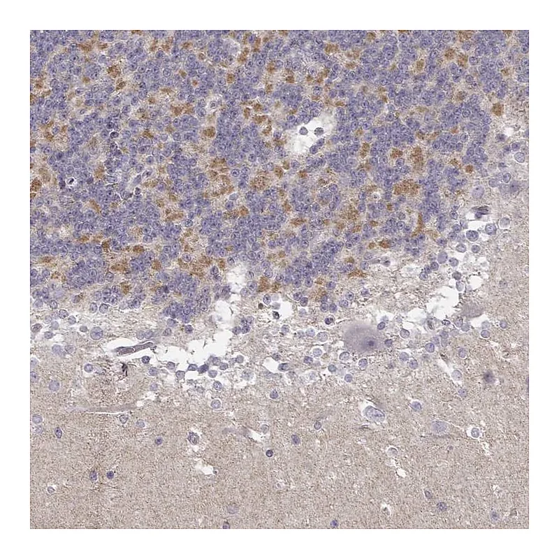 Atlas Antibodies Anti-TLX3 Antibody