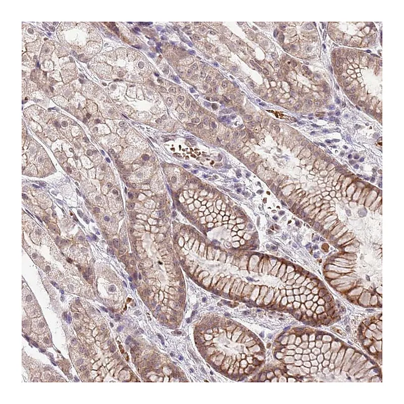 Atlas Antibodies Anti-TM2D1 Antibody