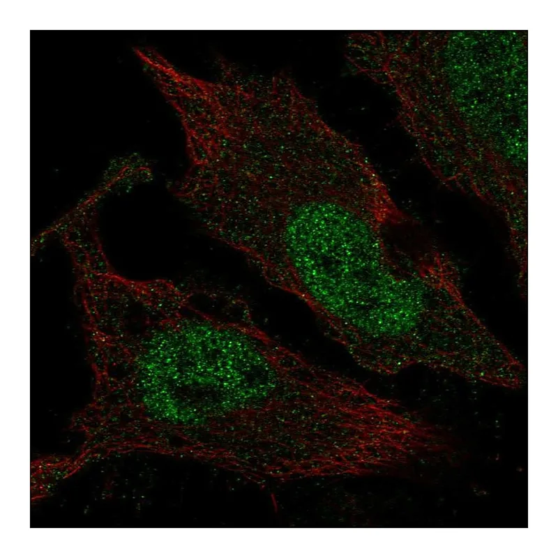 Atlas Antibodies Anti-TLX3 Antibody