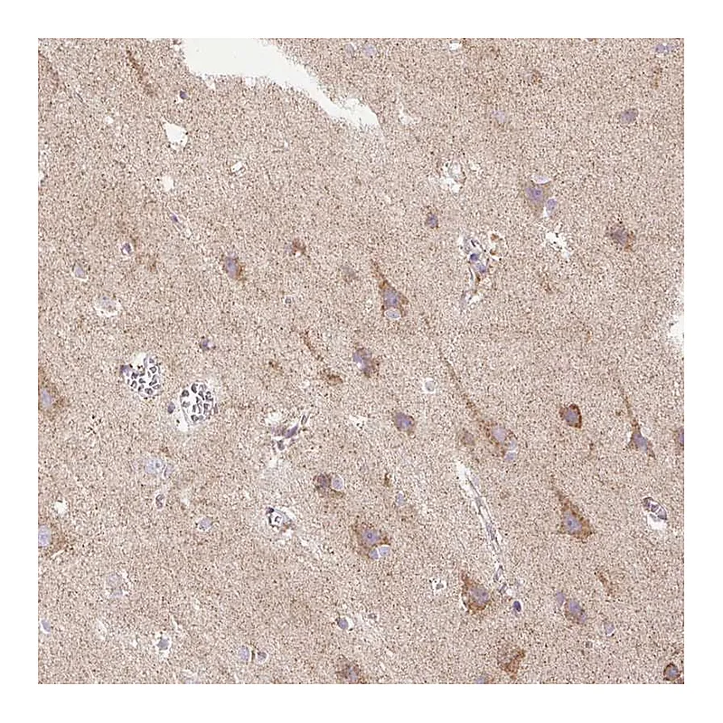Atlas Antibodies Anti-TM2D3 Antibody