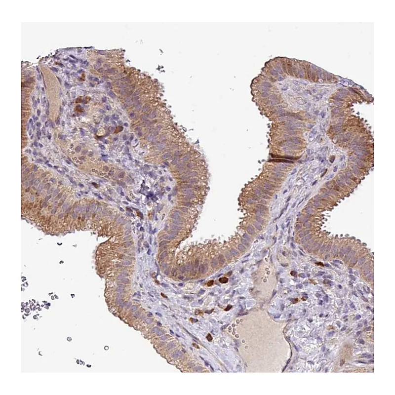 Atlas Antibodies Anti-TM2D2 Antibody