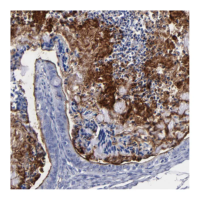 Atlas Antibodies Anti-TM4SF1 Antibody