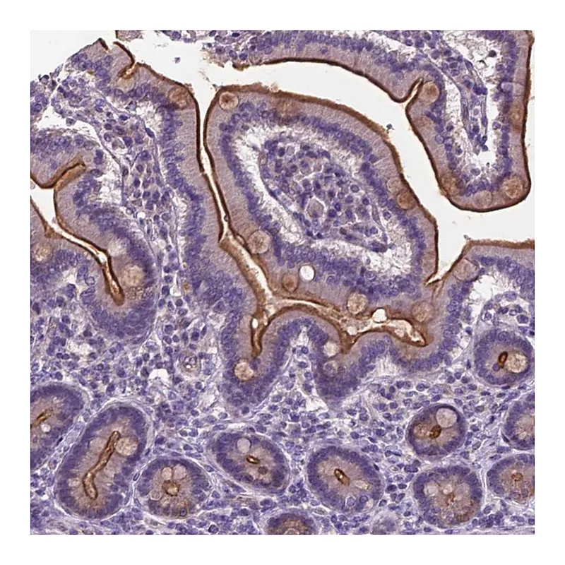 Atlas Antibodies Anti-TM4SF20 Antibody