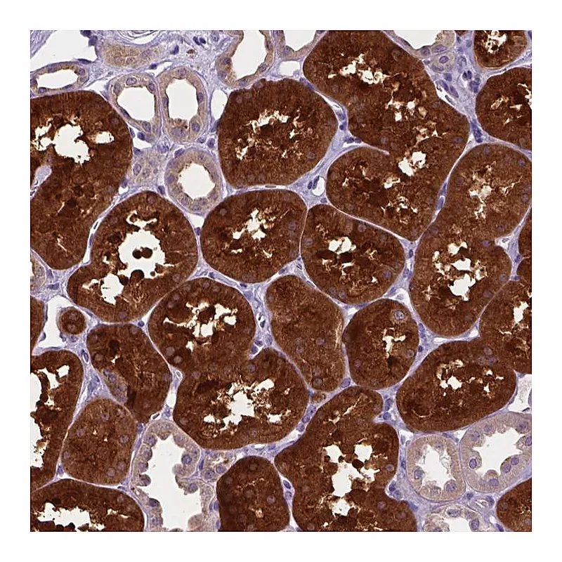 Atlas Antibodies Anti-TM4SF18 Antibody