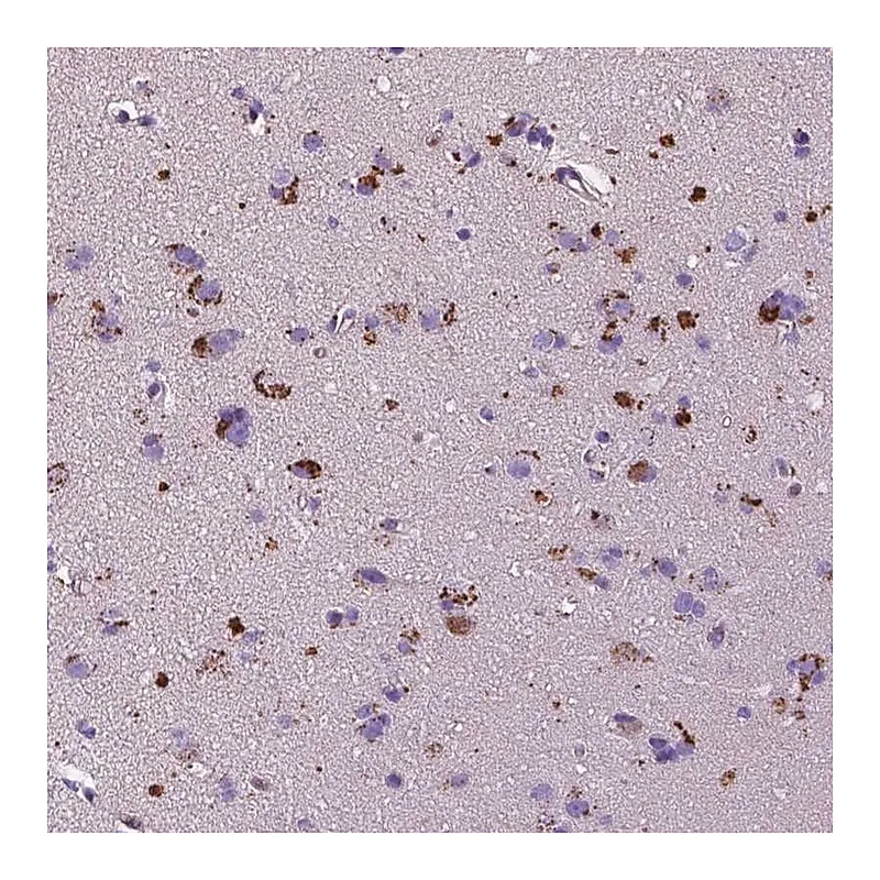 Atlas Antibodies Anti-TM4SF20 Antibody