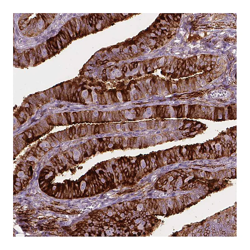 Atlas Antibodies Anti-TM6SF2 Antibody