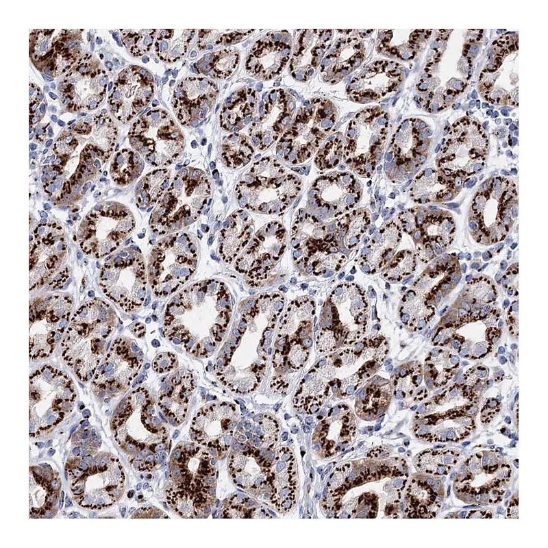 Atlas Antibodies Anti-TM9SF3 Antibody