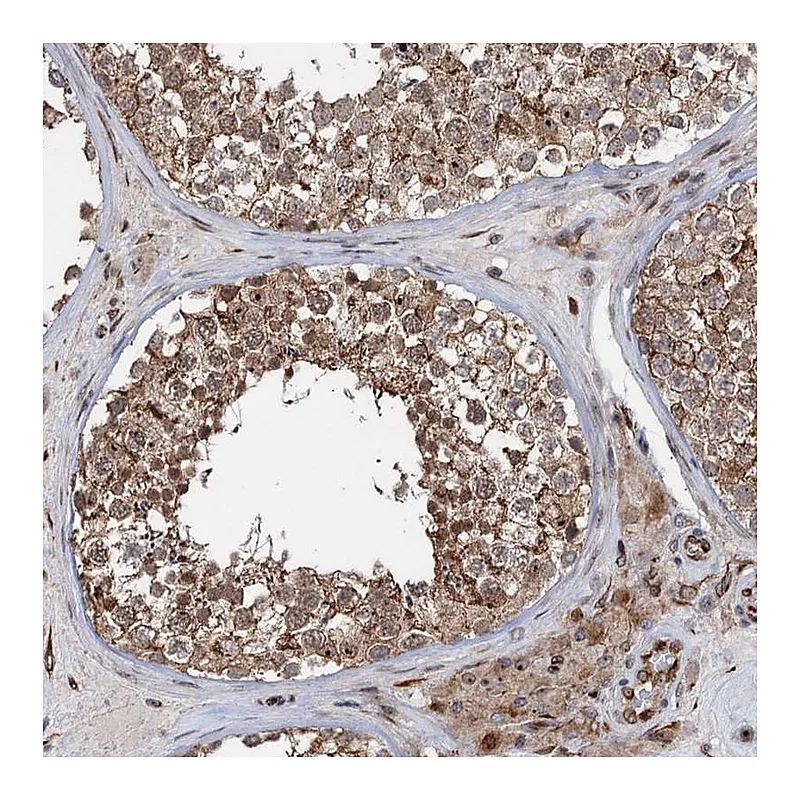 Atlas Antibodies Anti-TMA16 Antibody