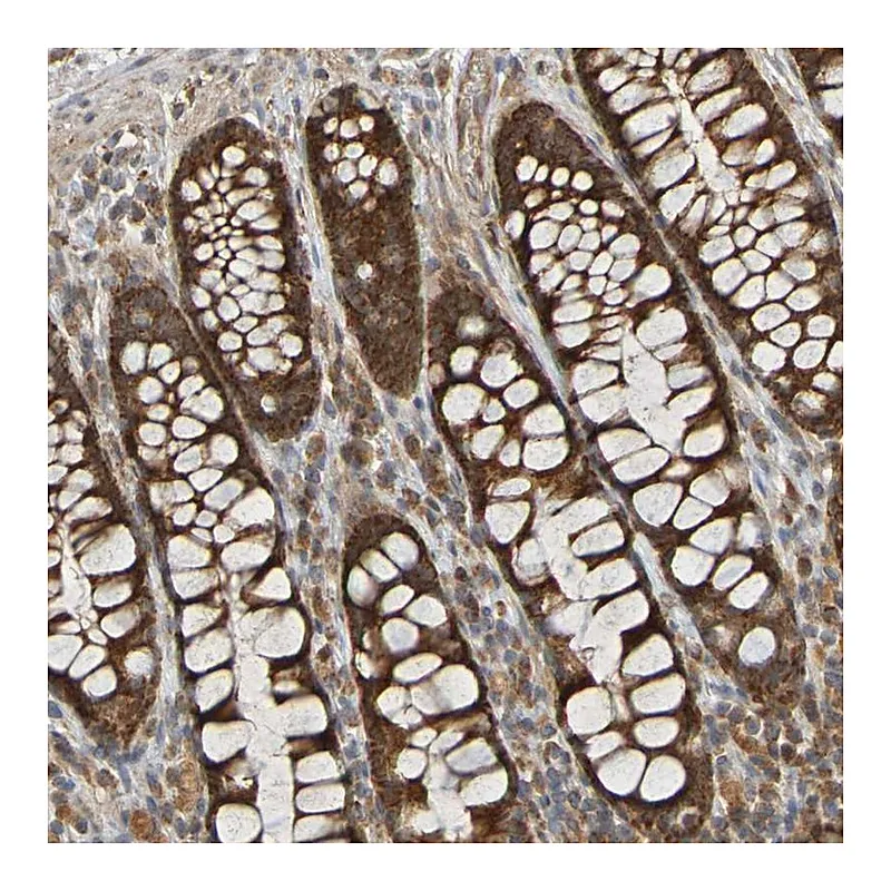 Atlas Antibodies Anti-TMBIM1 Antibody