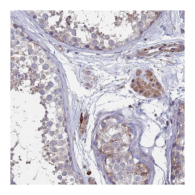 Atlas Antibodies Anti-TMBIM6 Antibody