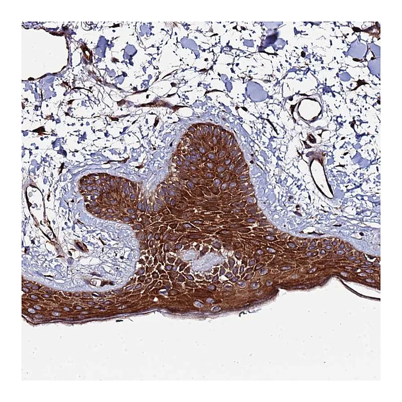 Atlas Antibodies Anti-TMC2 Antibody