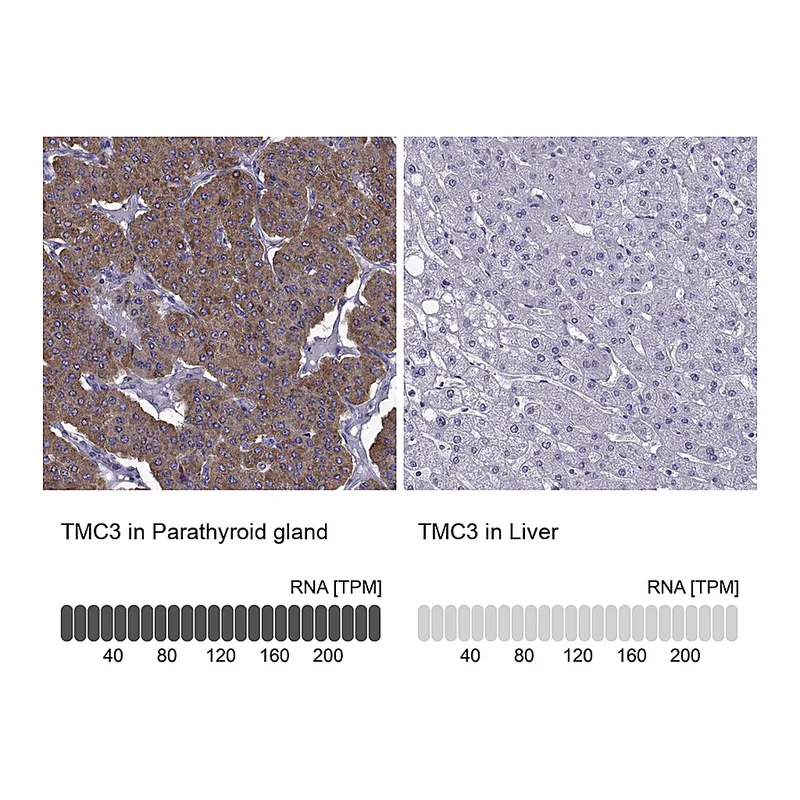 Atlas Antibodies Anti-TMC3 Antibody