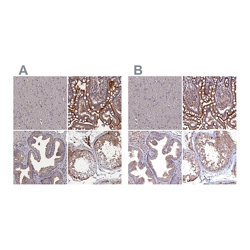 Atlas Antibodies Anti-TMC5 Antibody