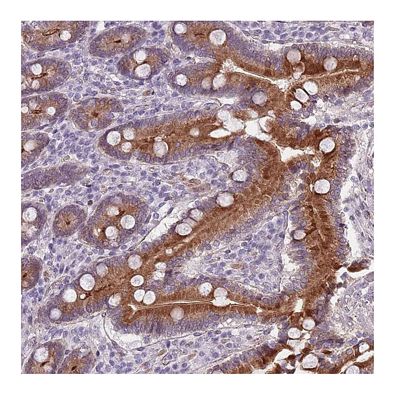 Atlas Antibodies Anti-TMC4 Antibody