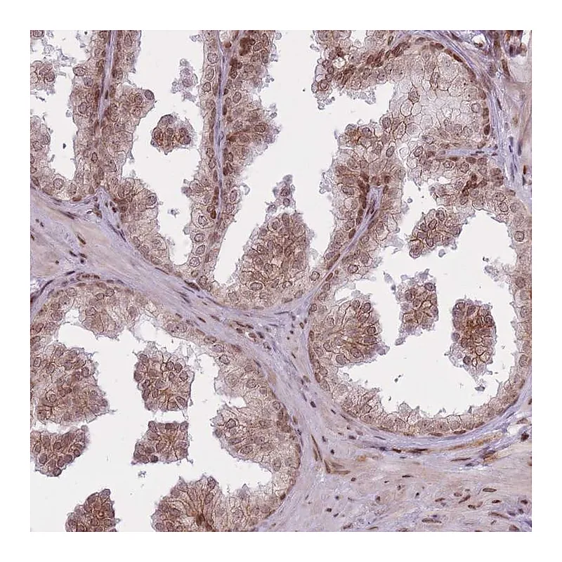 Atlas Antibodies Anti-TMC6 Antibody