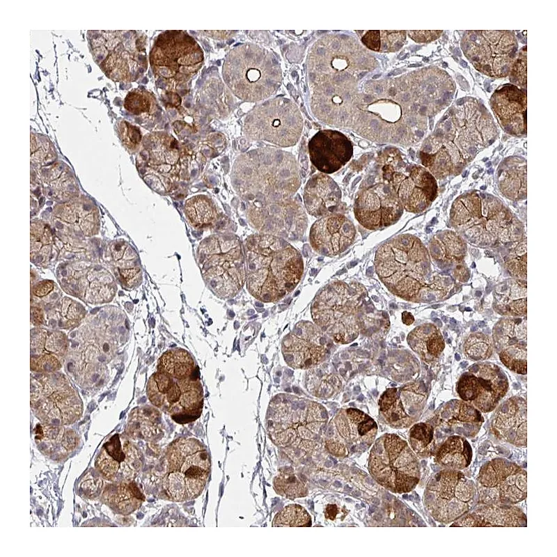 Atlas Antibodies Anti-TMCC1 Antibody