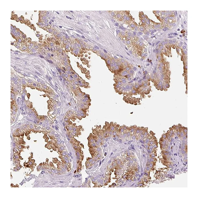 Atlas Antibodies Anti-TMC8 Antibody