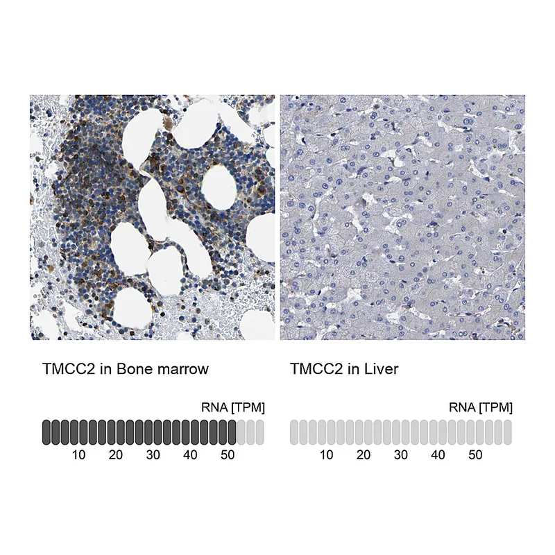 Atlas Antibodies Anti-TMCC2 Antibody
