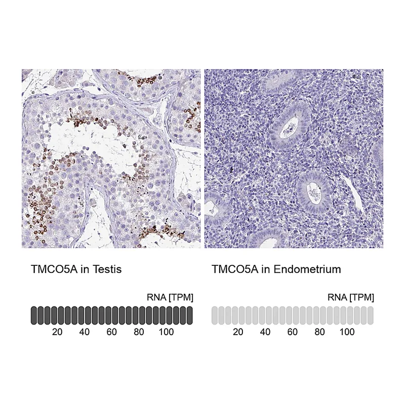 Atlas Antibodies Anti-TMCO5A Antibody