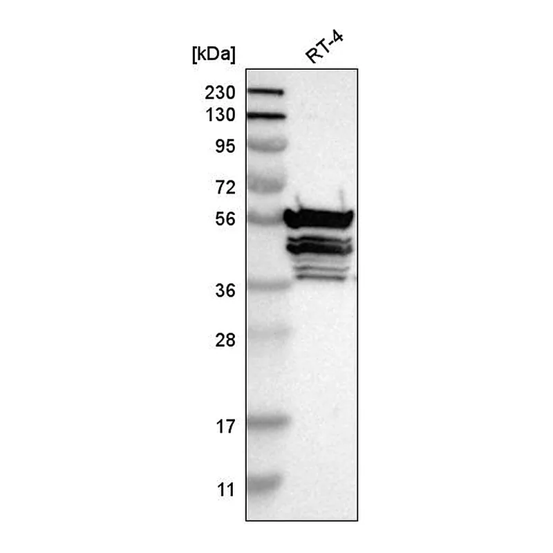 Atlas Antibodies Anti-TMCO4 Antibody