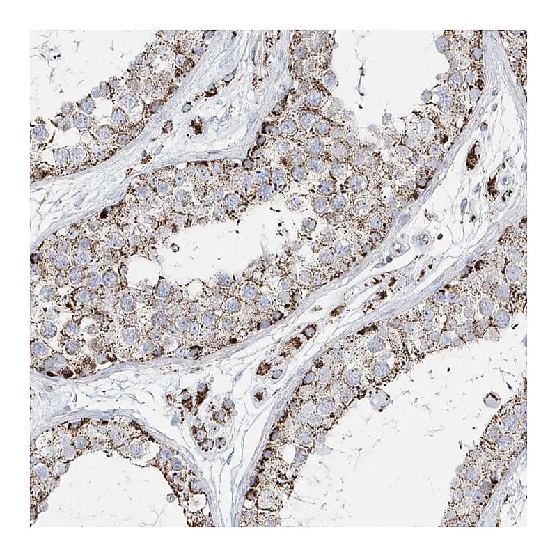 Atlas Antibodies Anti-TMCO6 Antibody