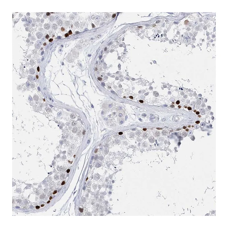 Atlas Antibodies Anti-TMCO6 Antibody