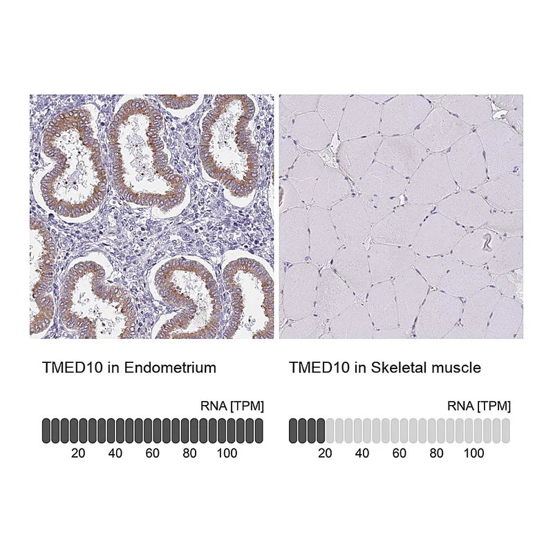 Atlas Antibodies Anti-TMED10 Antibody