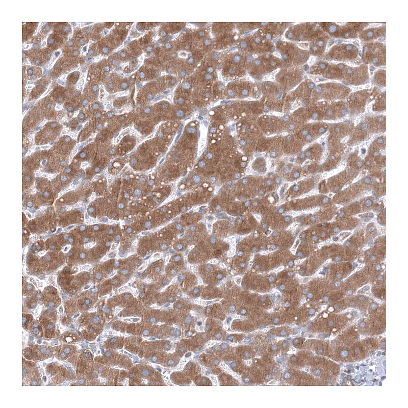 Atlas Antibodies Anti-TMED5 Antibody