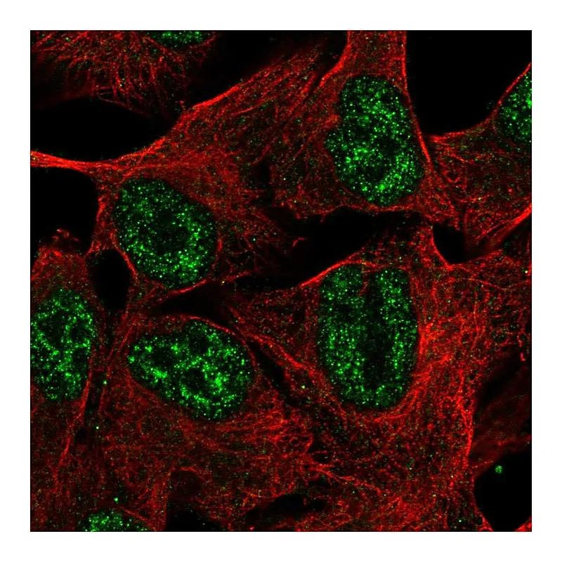 Atlas Antibodies Anti-TMEM101 Antibody