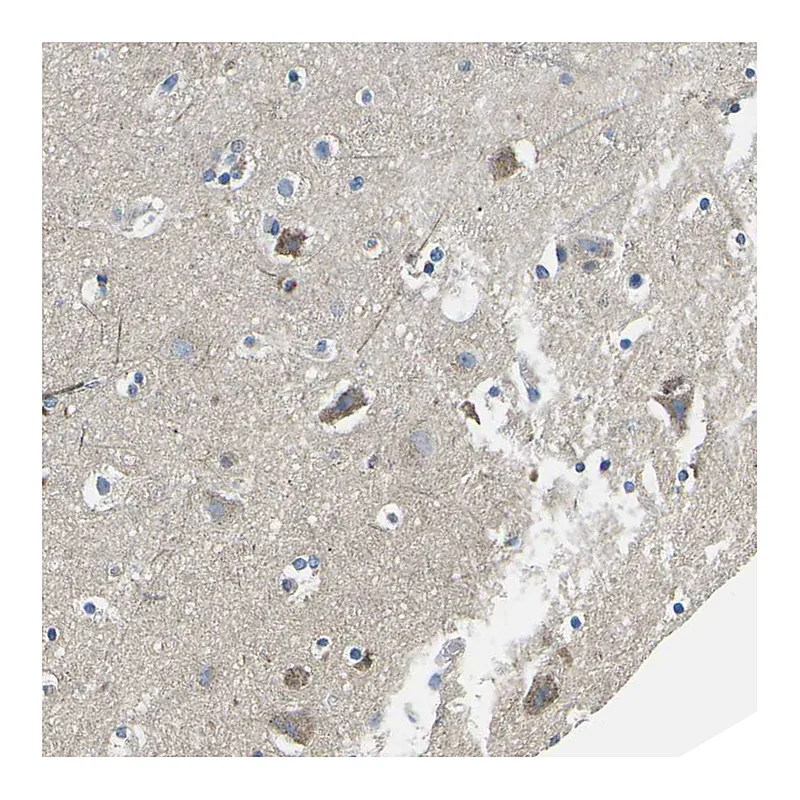 Atlas Antibodies Anti-TMEFF2 Antibody