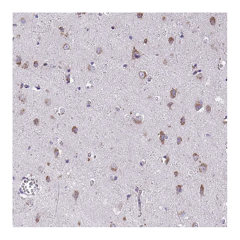 Atlas Antibodies Anti-TMEM106B Antibody