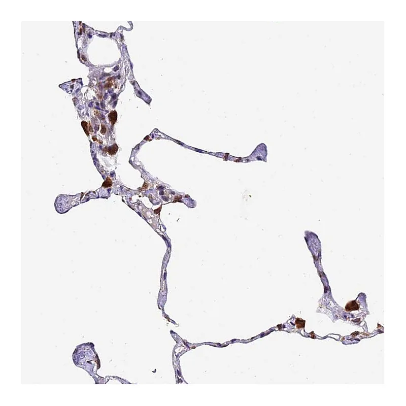 Atlas Antibodies Anti-TMEM104 Antibody
