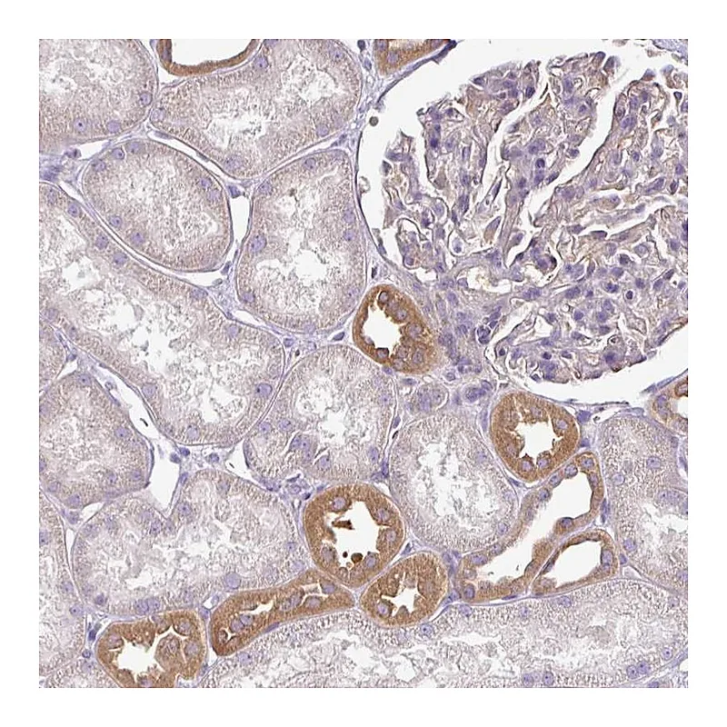 Atlas Antibodies Anti-TMEM107 Antibody