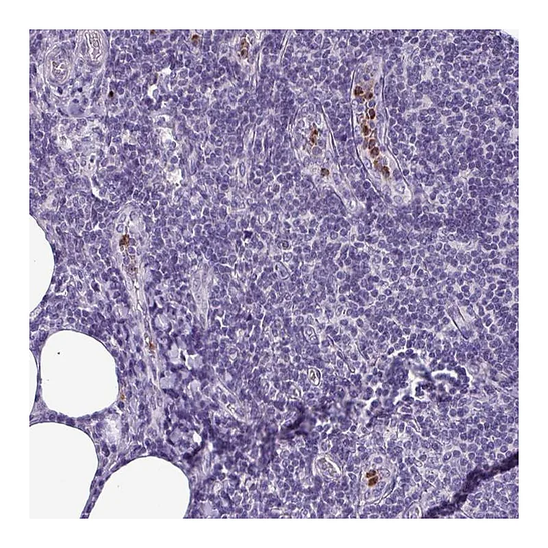 Atlas Antibodies Anti-TMEM11 Antibody