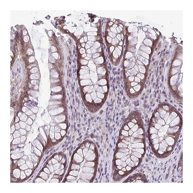 Atlas Antibodies Anti-TMEM108 Antibody