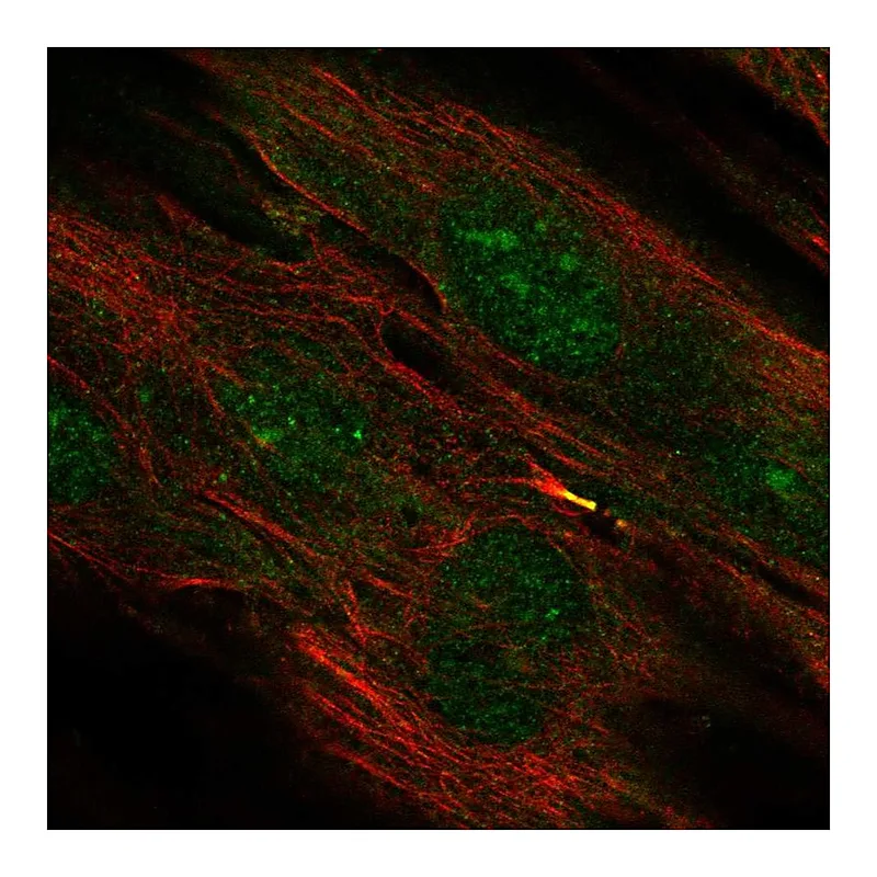 Atlas Antibodies Anti-TMEM117 Antibody