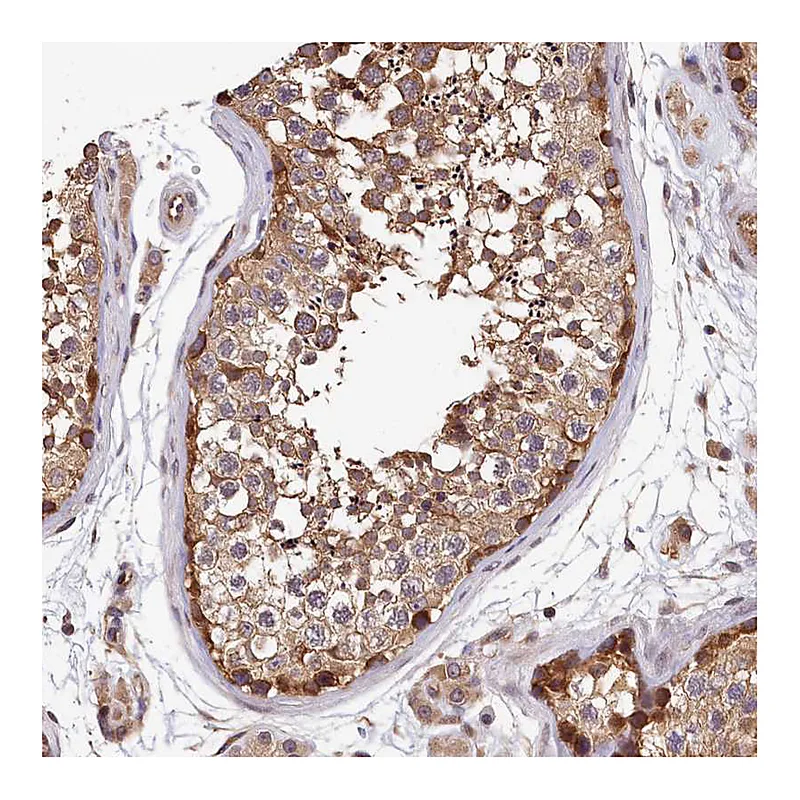 Atlas Antibodies Anti-TMEM116 Antibody