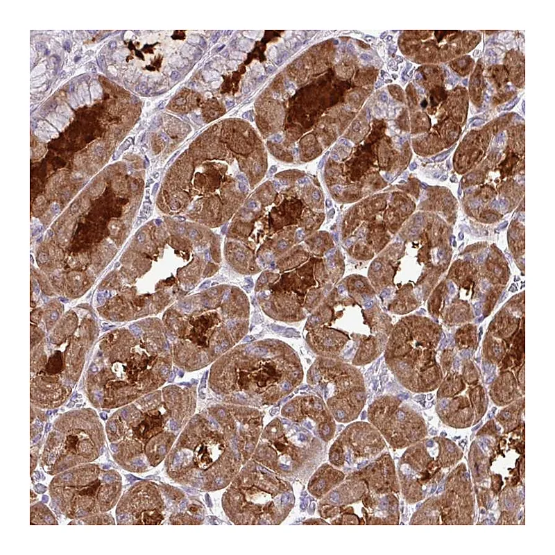 Atlas Antibodies Anti-TMEM110 Antibody