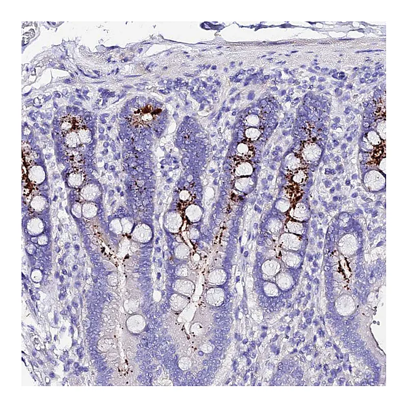 Atlas Antibodies Anti-TMEM117 Antibody