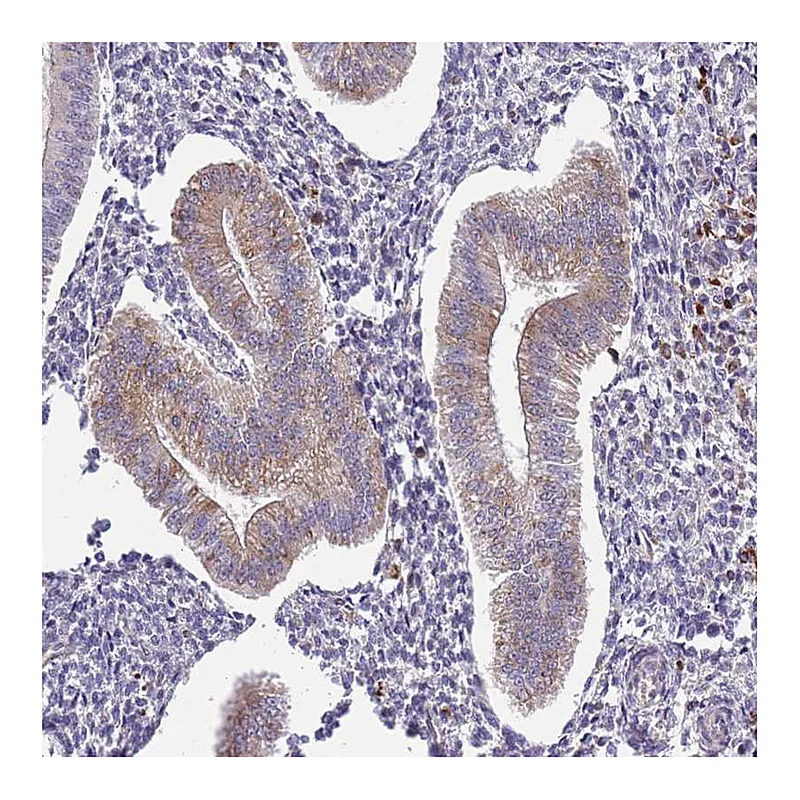 Atlas Antibodies Anti-TMEM121 Antibody