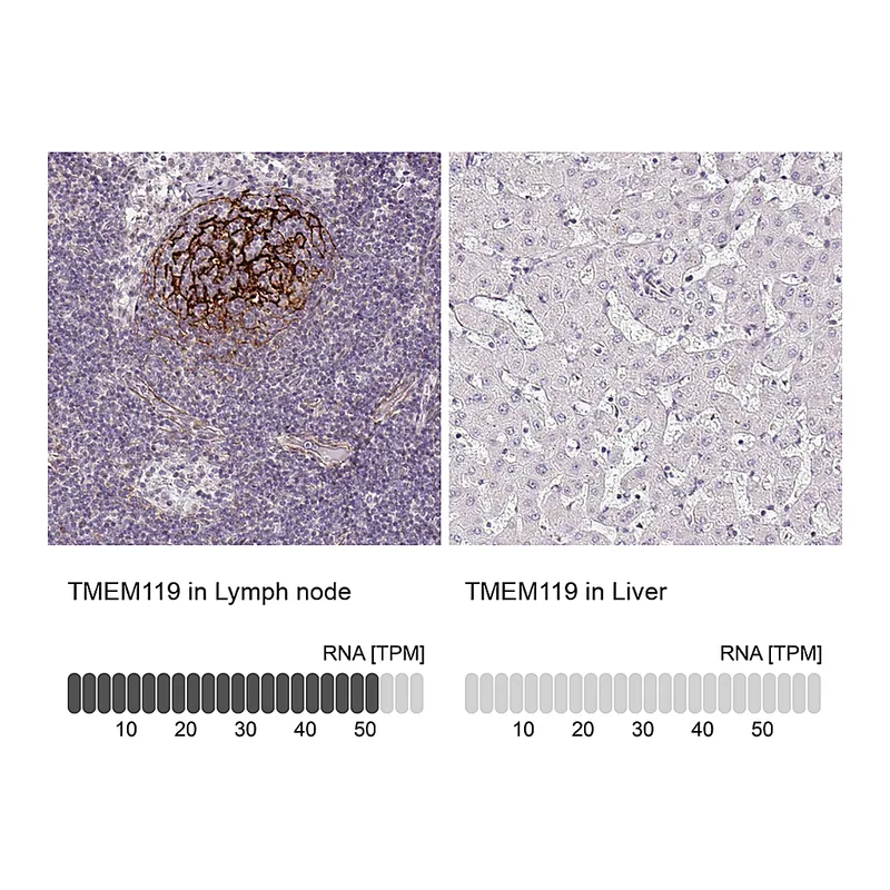 Atlas Antibodies Anti-TMEM119 Antibody