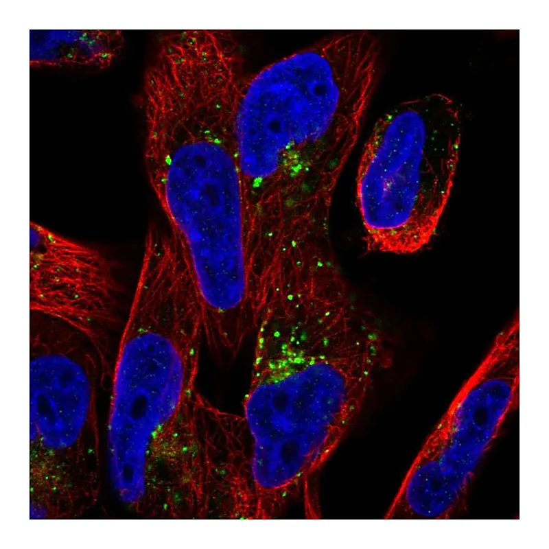 Atlas Antibodies Anti-TMEM123 Antibody