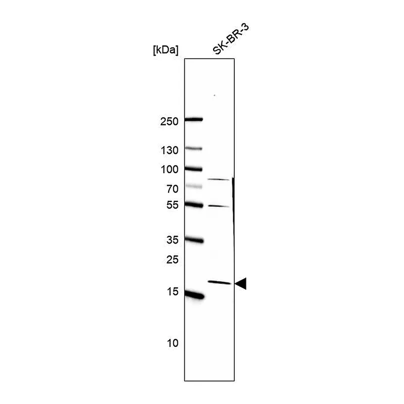 Atlas Antibodies Anti-TMEM125 Antibody