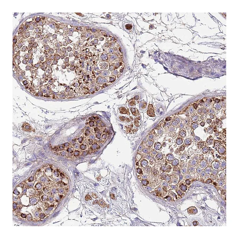 Atlas Antibodies Anti-TMEM126A Antibody